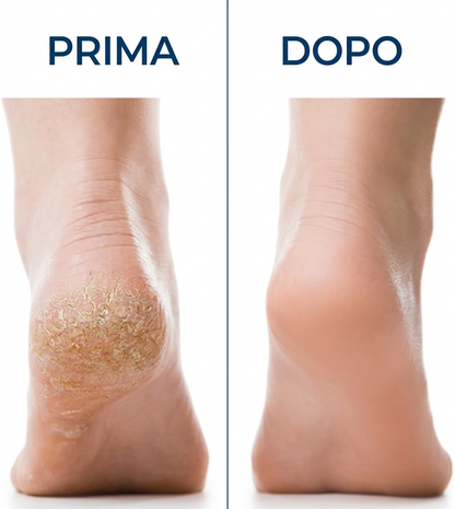 Velluko™ Limetta Elettrica per Piedi